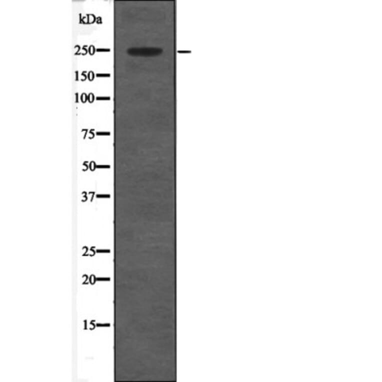 Western blot - CACNA1C (Phospho-Ser1927) Antibody from Signalway Antibody (12674) - Antibodies.com