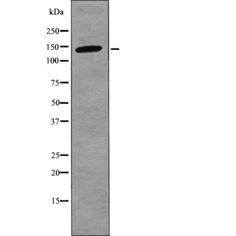 Western blot - Bamacan (Phospho-Ser1067) Antibody from Signalway Antibody (12744) - Antibodies.com