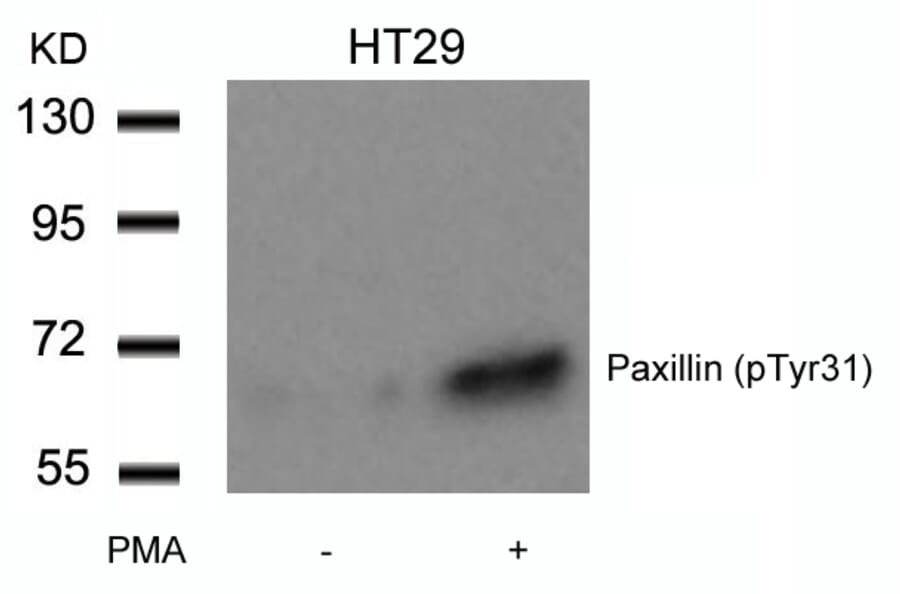 Western blot - Paxillin (Phospho-Tyr31) Antibody from Signalway Antibody (11201) - Antibodies.com