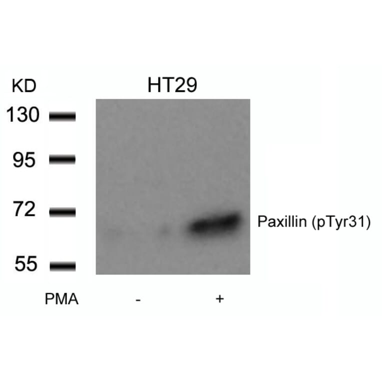 Western blot - Paxillin (Phospho-Tyr31) Antibody from Signalway Antibody (11201) - Antibodies.com