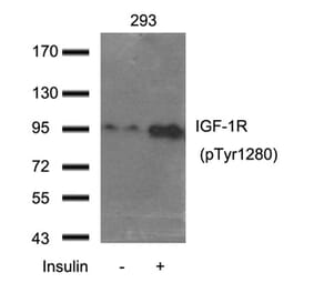 Western blot - IGF-1R (Phospho-Tyr1280) Antibody from Signalway Antibody (11302) - Antibodies.com