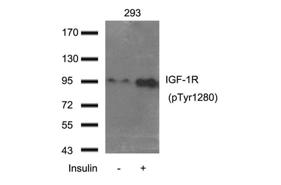 Western blot - IGF-1R (Phospho-Tyr1280) Antibody from Signalway Antibody (11302) - Antibodies.com