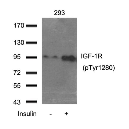 Western blot - IGF-1R (Phospho-Tyr1280) Antibody from Signalway Antibody (11302) - Antibodies.com