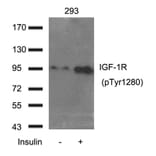 Western blot - IGF-1R (Phospho-Tyr1280) Antibody from Signalway Antibody (11302) - Antibodies.com