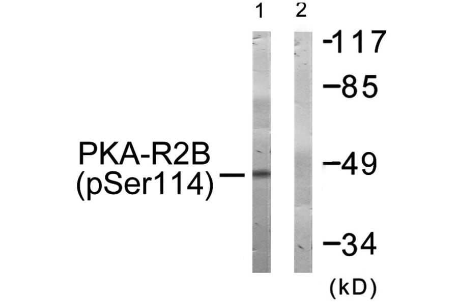 Western blot - PKA-R2β (Phospho-Ser114) Antibody from Signalway Antibody (11692) - Antibodies.com