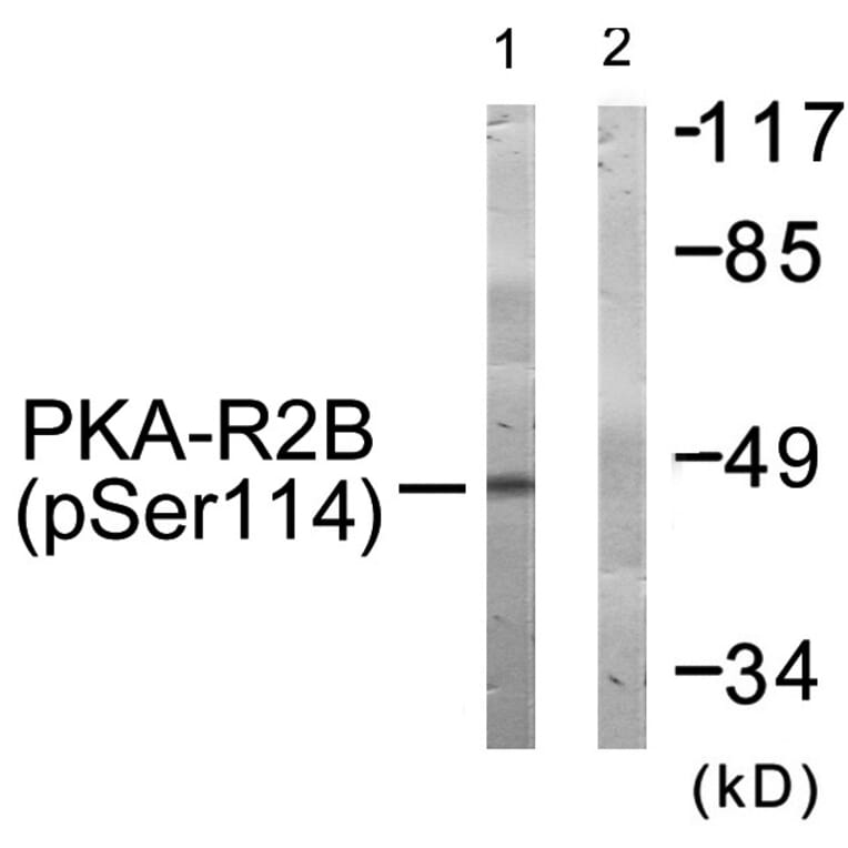 Western blot - PKA-R2β (Phospho-Ser114) Antibody from Signalway Antibody (11692) - Antibodies.com