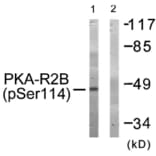 Western blot - PKA-R2β (Phospho-Ser114) Antibody from Signalway Antibody (11692) - Antibodies.com