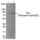 Western blot - Tau (Phospho-Ser202) Antibody from Signalway Antibody (11723) - Antibodies.com