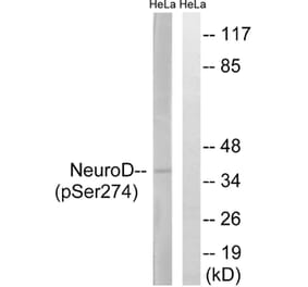 Western blot - Neuro D (Phospho-Ser274) Antibody from Signalway Antibody (11809) - Antibodies.com