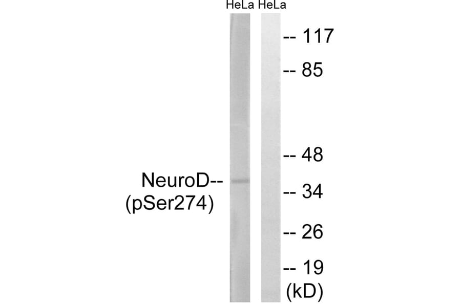 Western blot - Neuro D (Phospho-Ser274) Antibody from Signalway Antibody (11809) - Antibodies.com