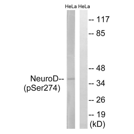 Western blot - Neuro D (Phospho-Ser274) Antibody from Signalway Antibody (11809) - Antibodies.com