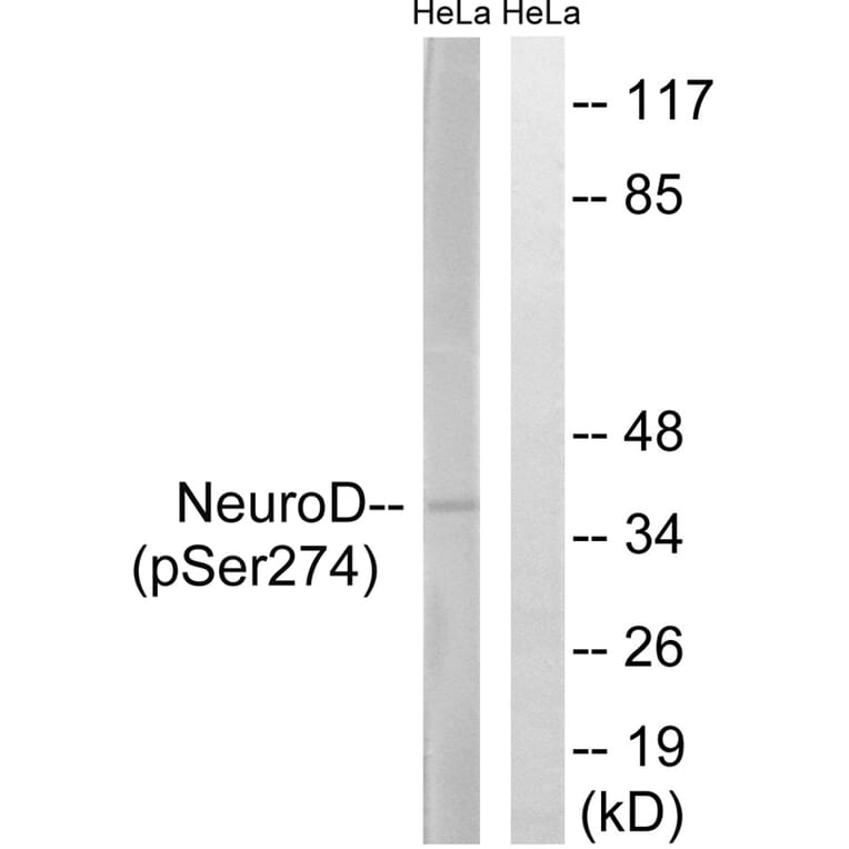 Western blot - Neuro D (Phospho-Ser274) Antibody from Signalway Antibody (11809) - Antibodies.com