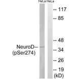 Western blot - Neuro D (Phospho-Ser274) Antibody from Signalway Antibody (11809) - Antibodies.com
