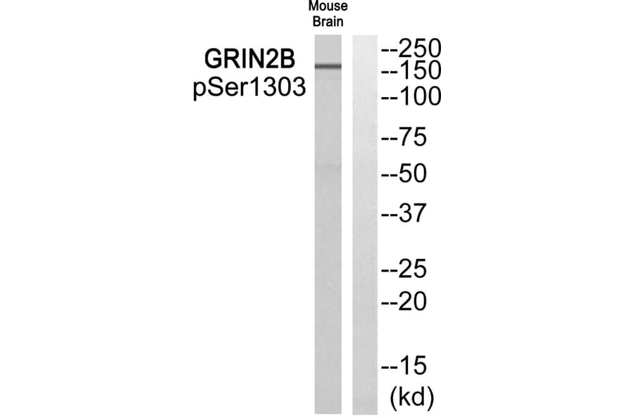 Western blot - GRIN2B (Phospho-Ser1303) Antibody from Signalway Antibody (11821) - Antibodies.com
