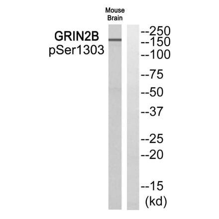Western blot - GRIN2B (Phospho-Ser1303) Antibody from Signalway Antibody (11821) - Antibodies.com