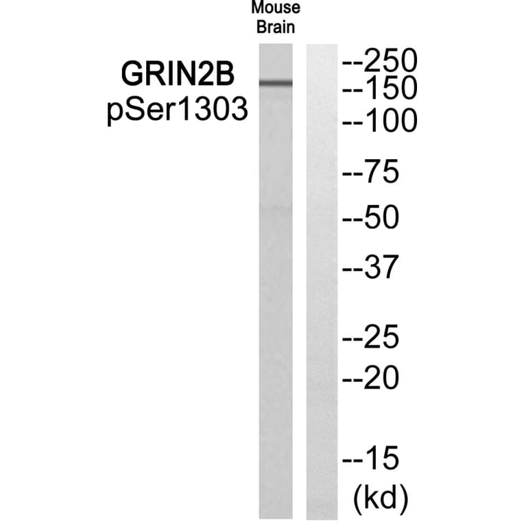 Western blot - GRIN2B (Phospho-Ser1303) Antibody from Signalway Antibody (11821) - Antibodies.com