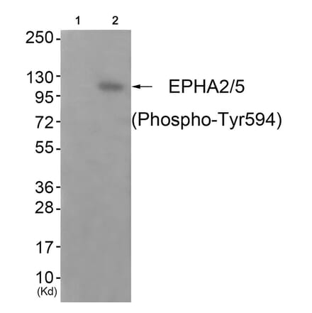 Western blot - EPHA2/5 (Phospho-Tyr594) Antibody from Signalway Antibody (11833) - Antibodies.com