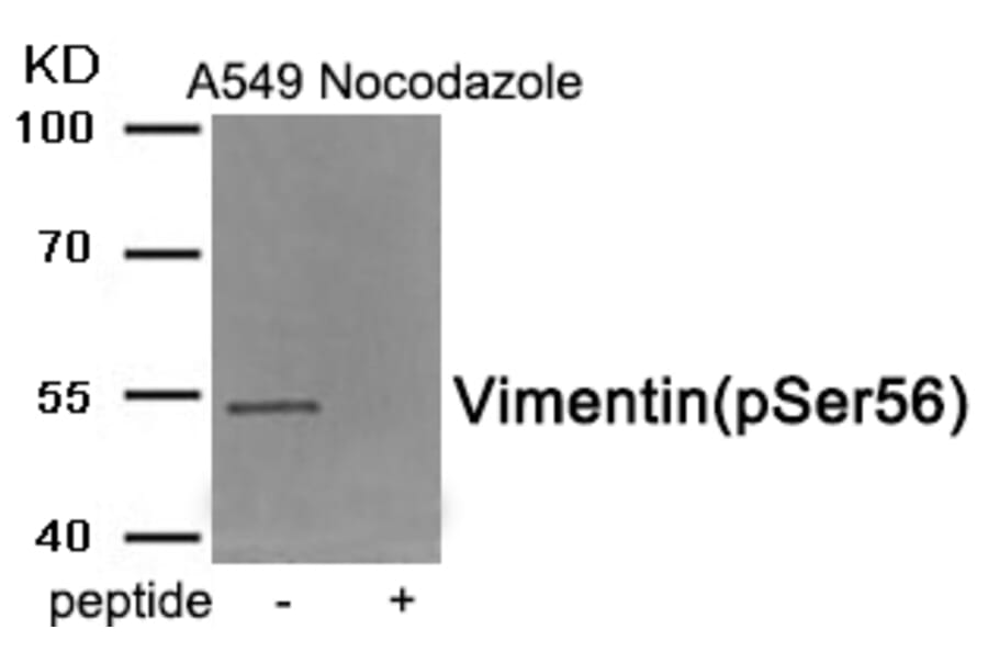 Western blot - Vimentin (Phospho-Ser56) Antibody from Signalway Antibody (11940) - Antibodies.com