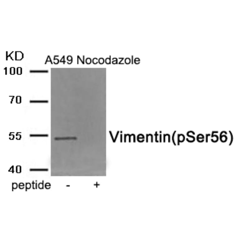 Western blot - Vimentin (Phospho-Ser56) Antibody from Signalway Antibody (11940) - Antibodies.com