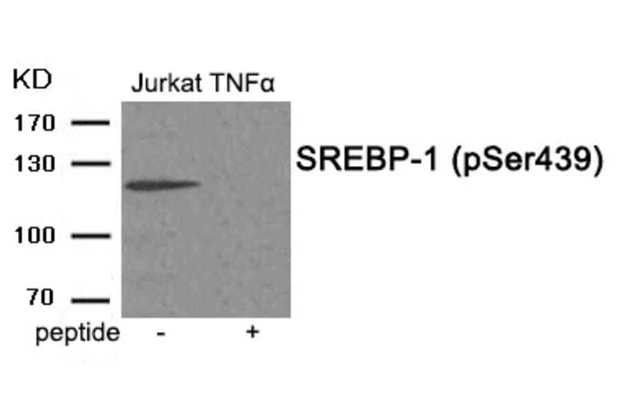 Western blot - SREBP-1 (Phospho-Ser439) Antibody from Signalway Antibody (11951) - Antibodies.com
