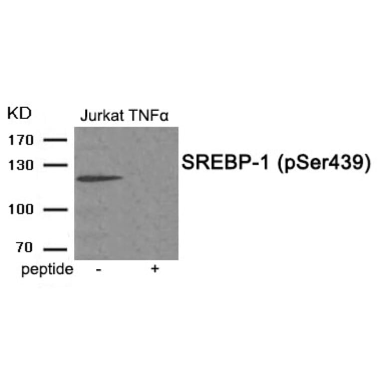 Western blot - SREBP-1 (Phospho-Ser439) Antibody from Signalway Antibody (11951) - Antibodies.com