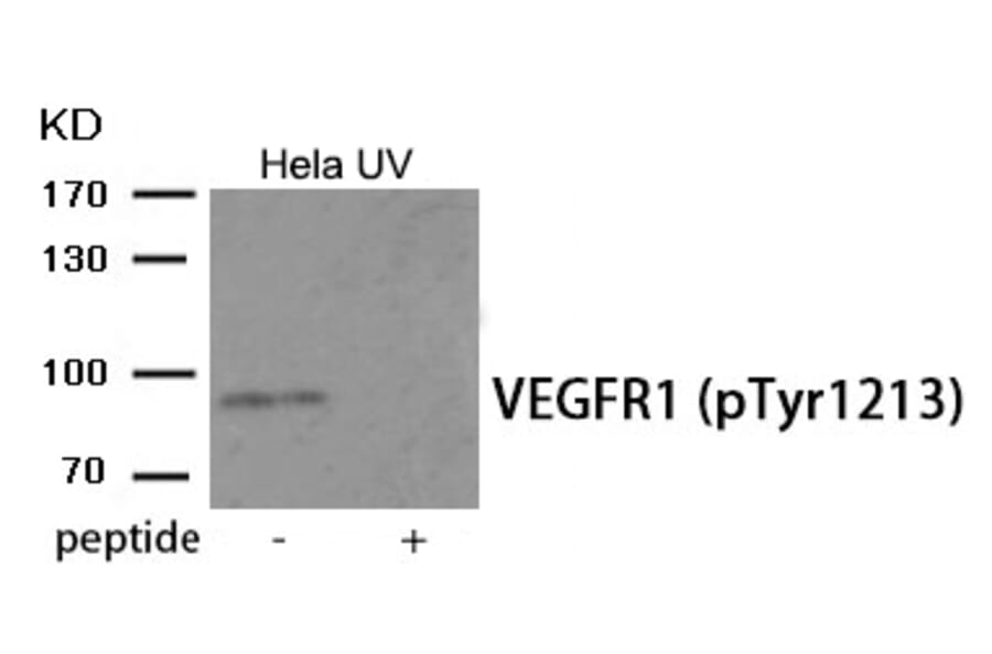 Western blot - VEGFR1 (Phospho-Tyr1213) Antibody from Signalway Antibody (11985) - Antibodies.com