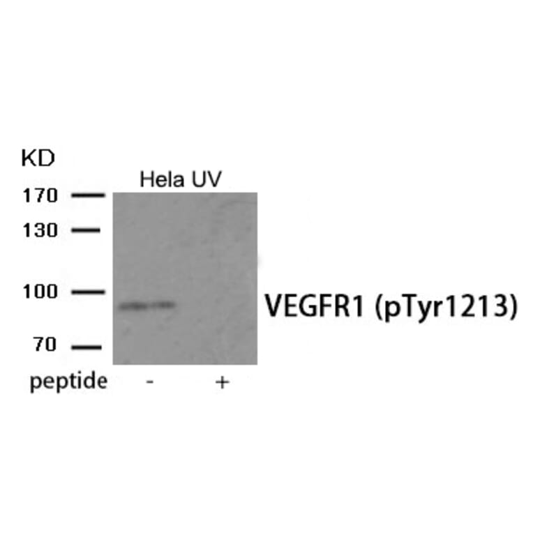 Western blot - VEGFR1 (Phospho-Tyr1213) Antibody from Signalway Antibody (11985) - Antibodies.com