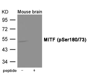 Western blot - MITF (Phospho-Ser180/73) Antibody from Signalway Antibody (12018) - Antibodies.com