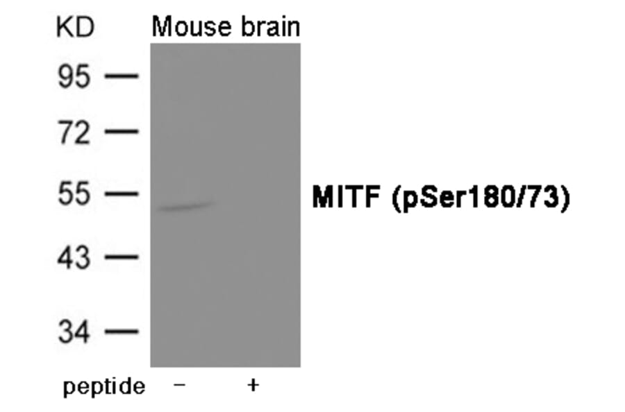 Western blot - MITF (Phospho-Ser180/73) Antibody from Signalway Antibody (12018) - Antibodies.com