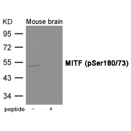 Western blot - MITF (Phospho-Ser180/73) Antibody from Signalway Antibody (12018) - Antibodies.com