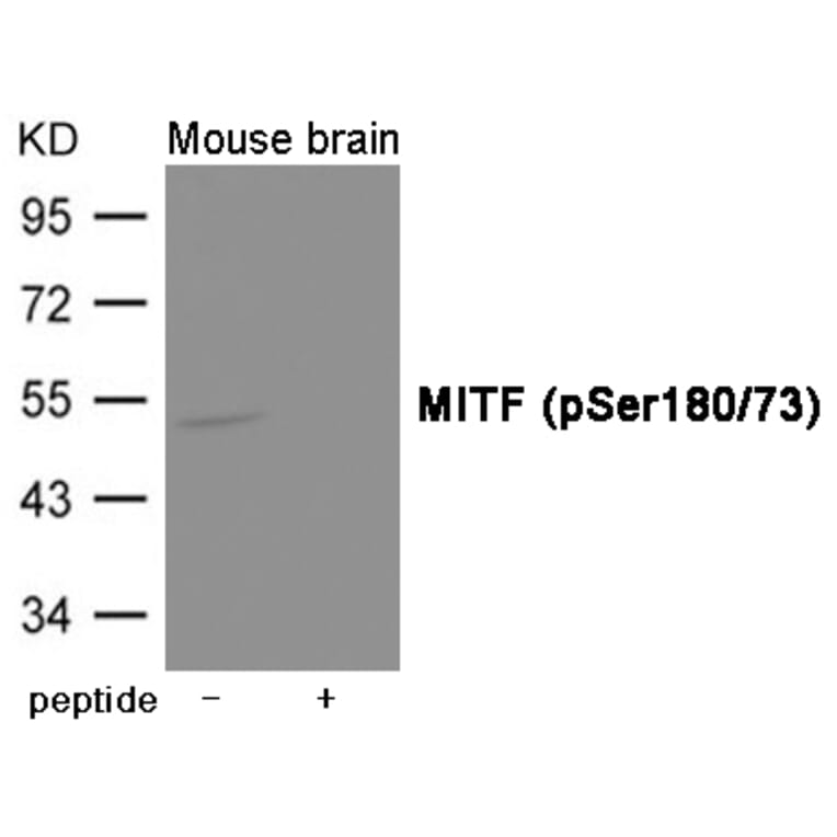 Western blot - MITF (Phospho-Ser180/73) Antibody from Signalway Antibody (12018) - Antibodies.com