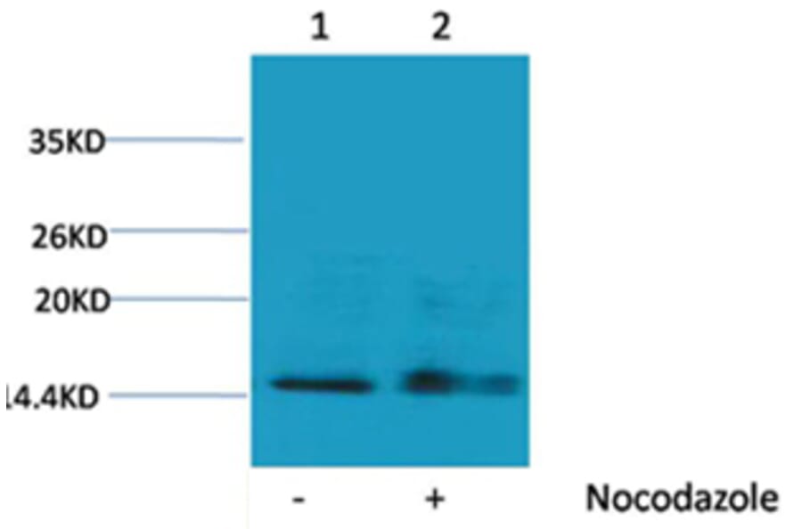 Western blot - Histone H1 (Phospho-Ser1) Rabbit Polyclonal Antibody from Signalway Antibody (12096) - Antibodies.com