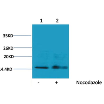 Western blot - Histone H1 (Phospho-Ser1) Rabbit Polyclonal Antibody from Signalway Antibody (12096) - Antibodies.com