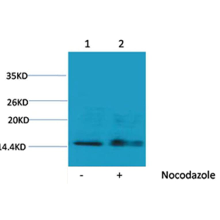 Western blot - Histone H1 (Phospho-Ser1) Rabbit Polyclonal Antibody from Signalway Antibody (12096) - Antibodies.com