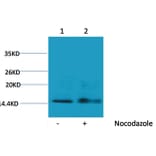 Western blot - Histone H1 (Phospho-Ser1) Rabbit Polyclonal Antibody from Signalway Antibody (12096) - Antibodies.com