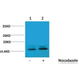 Western blot - Histone H1 (Phospho-Thr3) Rabbit Polyclonal Antibody from Signalway Antibody (12097) - Antibodies.com