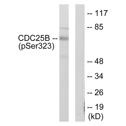 Western blot - CDC25B (Phospho-Ser323) Antibody from Signalway Antibody (12104) - Antibodies.com