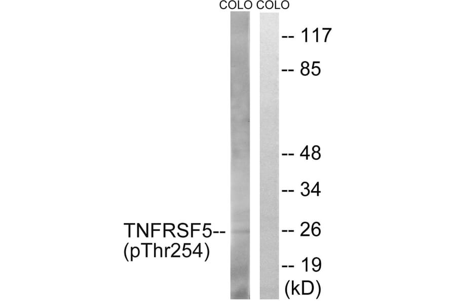 Western blot - TNFRSF5 (Phospho-Thr254) Antibody from Signalway Antibody (12109) - Antibodies.com
