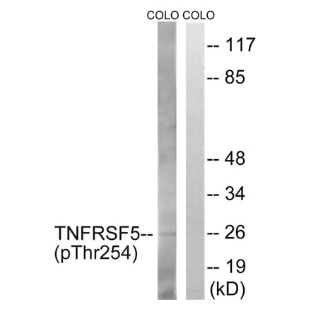 Western blot - TNFRSF5 (Phospho-Thr254) Antibody from Signalway Antibody (12109) - Antibodies.com