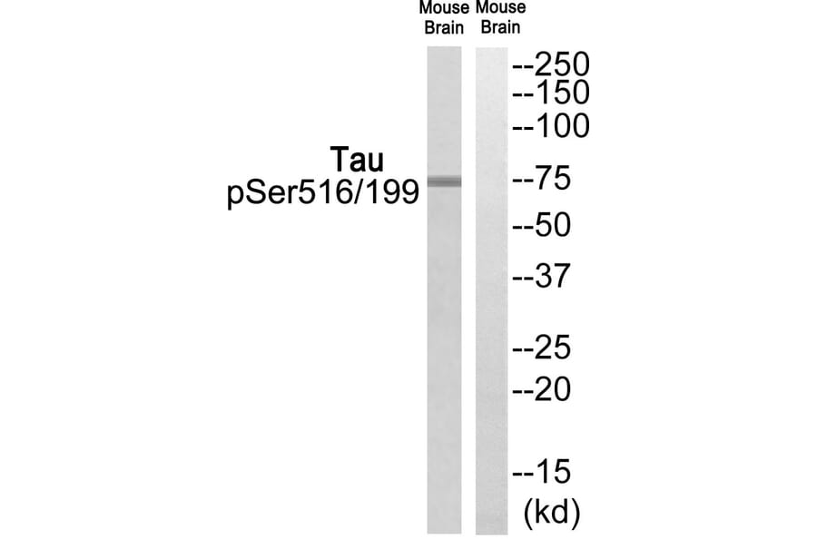 Western blot - Tau (Phospho-Ser516/199) Antibody from Signalway Antibody (12123) - Antibodies.com
