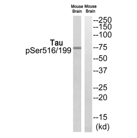 Western blot - Tau (Phospho-Ser516/199) Antibody from Signalway Antibody (12123) - Antibodies.com