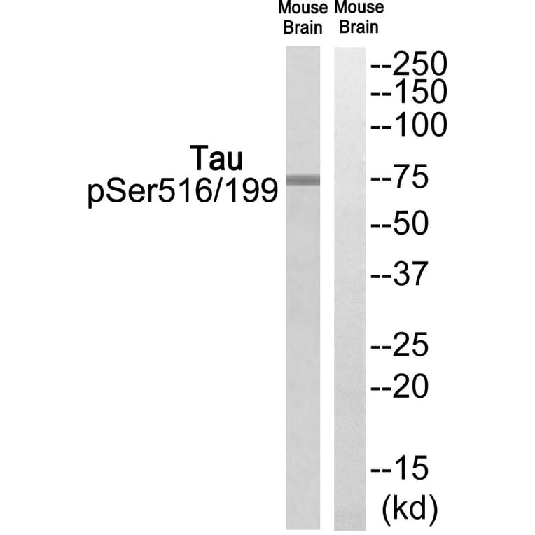 Western blot - Tau (Phospho-Ser516/199) Antibody from Signalway Antibody (12123) - Antibodies.com