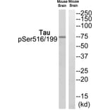 Western blot - Tau (Phospho-Ser516/199) Antibody from Signalway Antibody (12123) - Antibodies.com