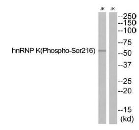 Western blot - hnRNP K (Phospho-Ser216) Antibody from Signalway Antibody (12140) - Antibodies.com