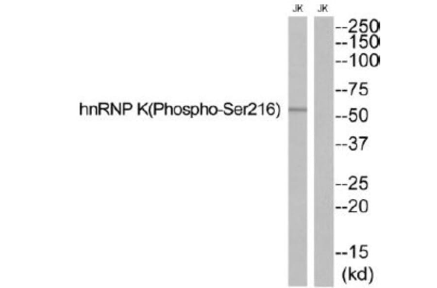 Western blot - hnRNP K (Phospho-Ser216) Antibody from Signalway Antibody (12140) - Antibodies.com