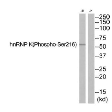 Western blot - hnRNP K (Phospho-Ser216) Antibody from Signalway Antibody (12140) - Antibodies.com