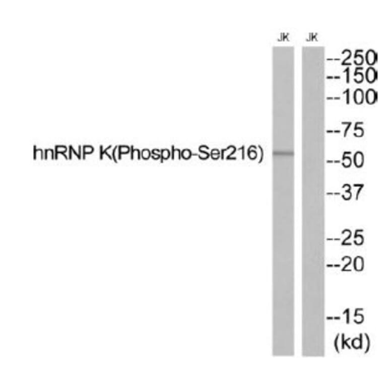 Western blot - hnRNP K (Phospho-Ser216) Antibody from Signalway Antibody (12140) - Antibodies.com