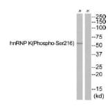 Western blot - hnRNP K (Phospho-Ser216) Antibody from Signalway Antibody (12140) - Antibodies.com