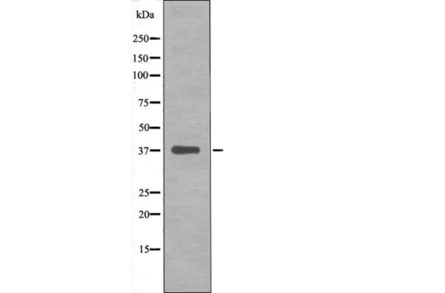 Western blot - C/EBP-α (Phospho-Ser193) Antibody from Signalway Antibody (12422) - Antibodies.com