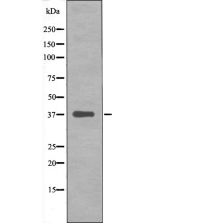 Western blot - C/EBP-α (Phospho-Ser193) Antibody from Signalway Antibody (12422) - Antibodies.com